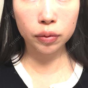 Wing clinic 豊中駅前院口コミ