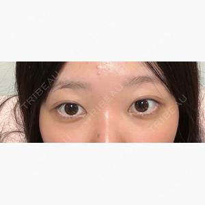 銀座みゆき通り美容外科 大阪梅田院口コミ