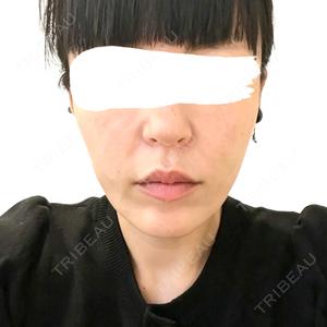Tokyo Tensei Clinic 大阪梅田院口コミ