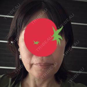 TCB東京中央美容外科 心斎橋院口コミ