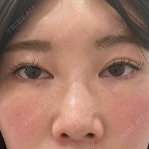 新宿美容外科ネビュラクリニック口コミ