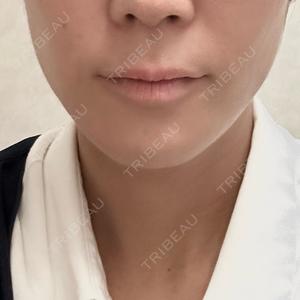 Wi Clinic （ウィ クリニック）心斎橋院口コミ
