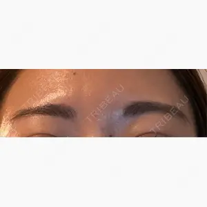 HAAB×DREAM BEAUTY CLINIC 東京本院口コミ