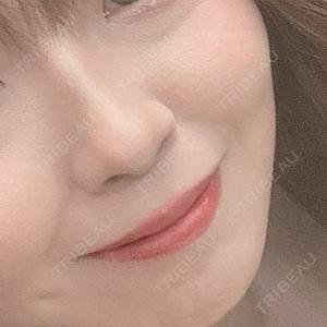 札幌美容外科ネビュラクリニック口コミ