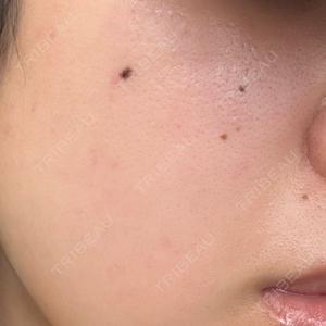 KARIS beauty clinic口コミ