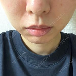 ウィルビークリニック 銀座院口コミ