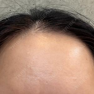 PRO CLINIC プロクリニック 銀座院口コミ