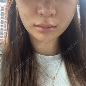 PRO CLINIC プロクリニック 銀座院口コミ