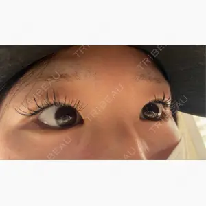 R Beauty CLINIC 銀座院口コミ