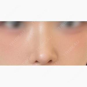 HAAB×DREAM BEAUTY CLINIC 大阪梅田院口コミ