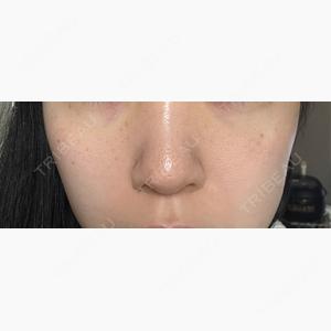 渋谷あおぞらクリニック美容外科・美容皮膚科口コミ