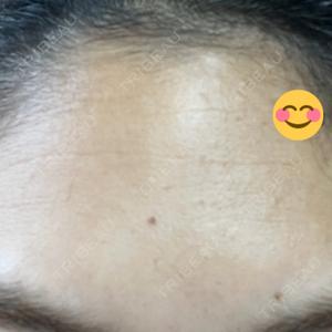 PRO CLINIC プロクリニック 銀座院口コミ