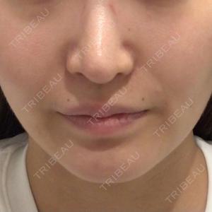 R Beauty CLINIC 名古屋院口コミ