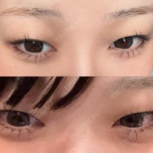 PRO CLINIC プロクリニック 銀座院口コミ