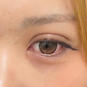 東京シンデレラ美容外科 大宮院口コミ