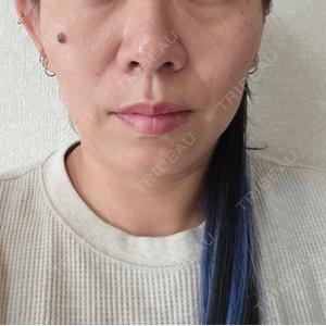東京形成美容外科 船橋院口コミ