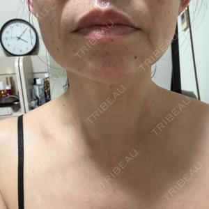 広島本通り美容クリニック口コミ
