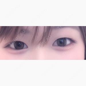 R Beauty CLINIC 名古屋院口コミ