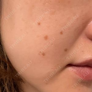 KARIS beauty clinic口コミ