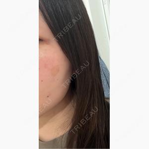 Fellez Clinic【フェルズクリニック】口コミ