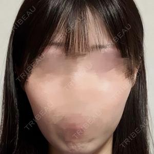 S.T styleクリニック口コミ