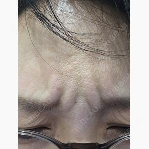 アリエル美容クリニック 大宮院口コミ