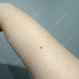 R Beauty CLINIC 名古屋院口コミ