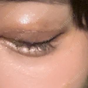 ルラ美容クリニック 宇都宮院口コミ