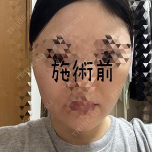 ルラ美容クリニック 池袋院口コミ