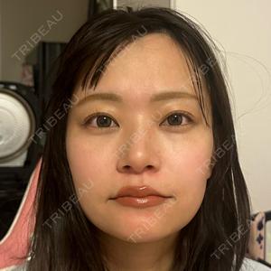 HAAB BEAUTY CLINIC 名古屋院口コミ