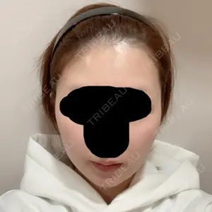 ボンディ美容整形外科（旧リオン整形外科）口コミ