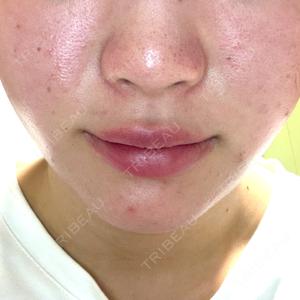 ルラ美容クリニック 宇都宮院口コミ