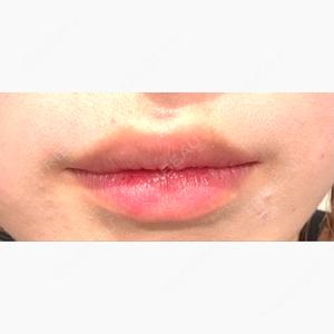 R Beauty CLINIC 名古屋院口コミ