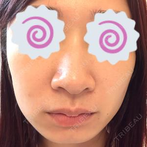 ルラ美容クリニック銀座院口コミ