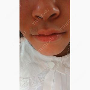 ルラ美容クリニック 新宿院口コミ