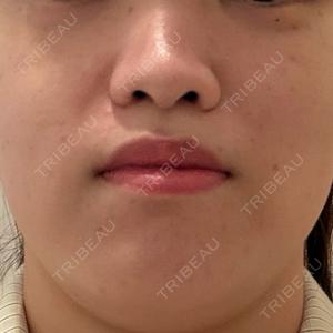 ルラ美容クリニック 池袋院口コミ