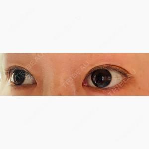 Tokyo Tensei Clinic 大阪梅田院口コミ