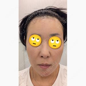 ルラ美容クリニック 宇都宮院口コミ
