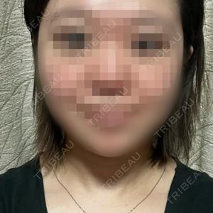 ヴァージンクリニック 福岡天神院口コミ