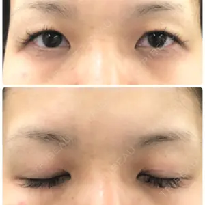 きくな湯田眼科口コミ