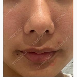R Beauty CLINIC 名古屋院口コミ