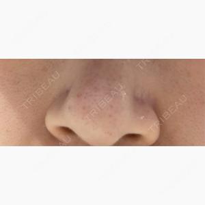 KARIS beauty clinic口コミ