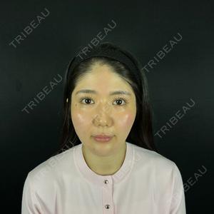 藤・ナチュレ美容クリニック 銀座院口コミ