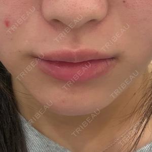 NARU Beauty Clinic 【ナルクリ】 水戸院口コミ
