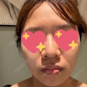 HAAB×DREAM BEAUTY CLINIC 東京本院口コミ