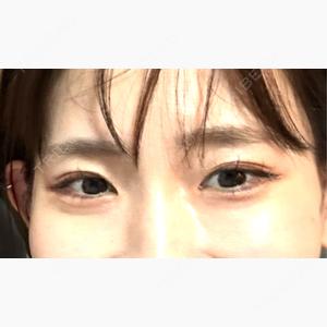 ルラ美容クリニック 大阪本院口コミ