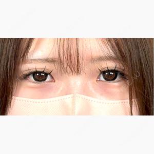 アリエル美容クリニック 大宮院口コミ