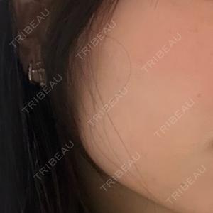 DMTC美容皮膚科 大宮院口コミ