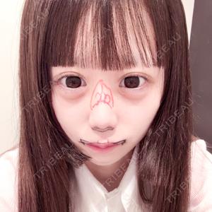 R Beauty CLINIC 銀座院口コミ