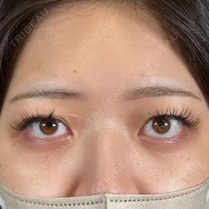 R Beauty CLINIC 名古屋院口コミ